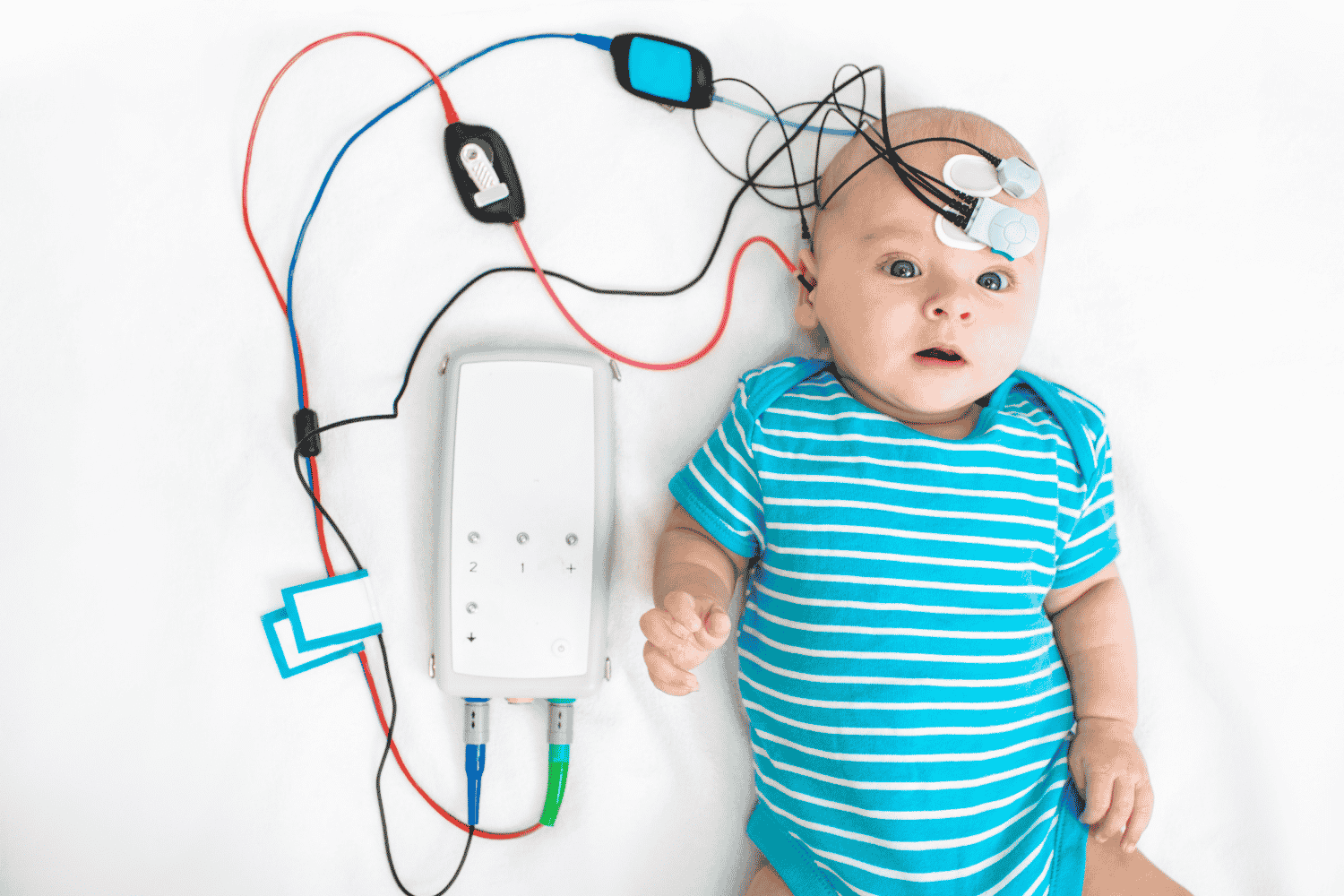 auditory brainstem response